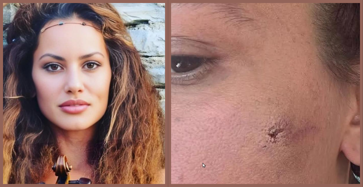 Oyuncu ve Müzisyen Yıldız Asyalı, Eşi Tarafından Şiddet Gördüğünü Açıkladı